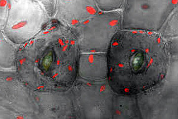 Physcomitrella-Zellen